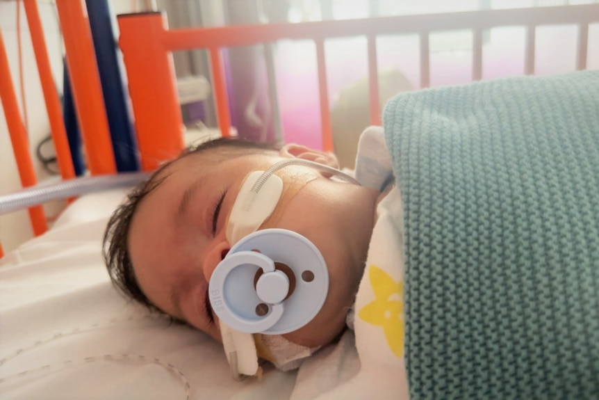 A small baby wrapped in a blanket. He is sleeping and his face is obscured by a dummy and nasal feeding tube