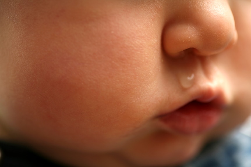 baby with snot coming out of its nose