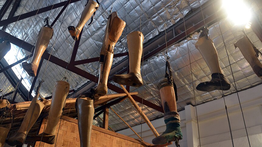 Prosthetic legs hang from the ceiling of the COPE visitors' centre