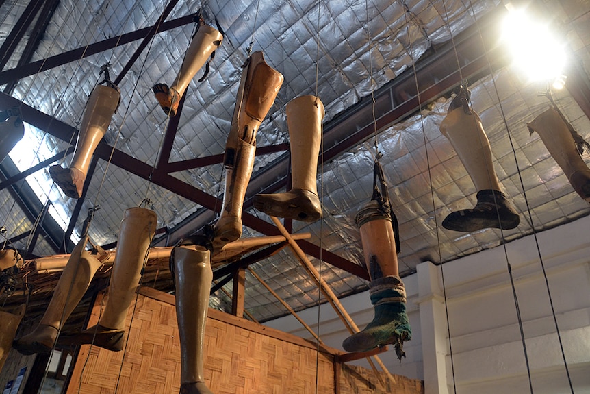 Prosthetic legs hang from the ceiling of the COPE visitors' centre