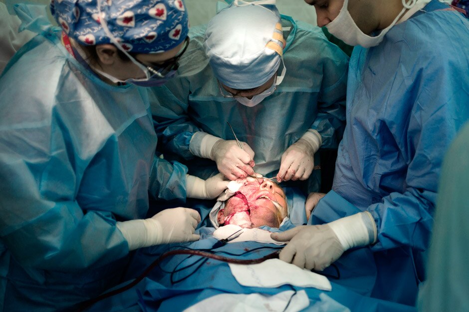 Volunteer Canadian doctors repair the eye socket of a wounded Ukrainain soldier.