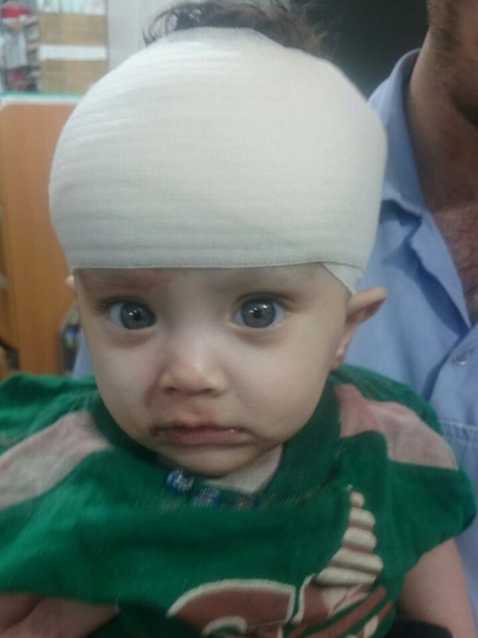 Eight-month-old Khaled in Aleppo