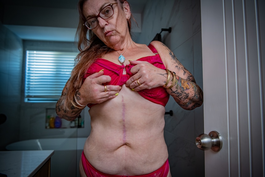 Dee looks down at the camera wearing underwear, showing a scar running down her stomach.