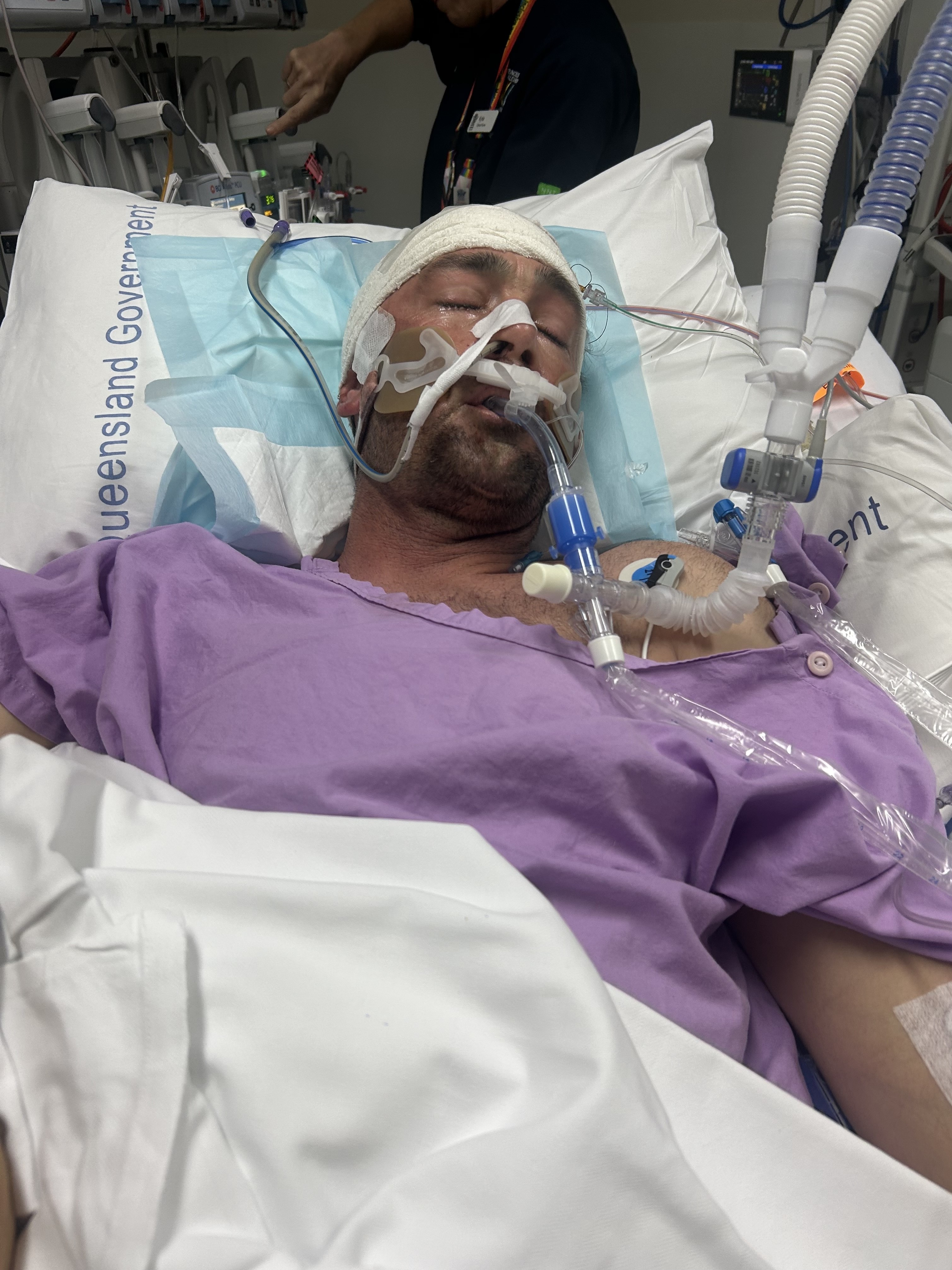 A man in a hospital bed with bandages on his head and tubes in his mouth