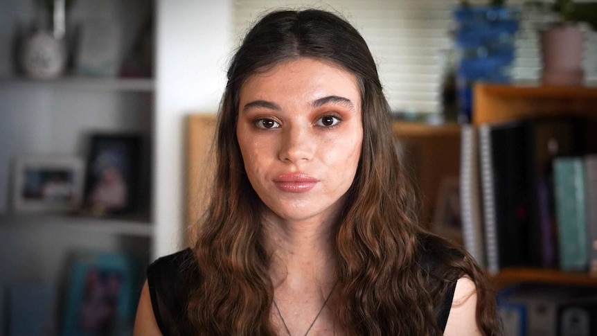 Head shot of a young woman staring at the camera.