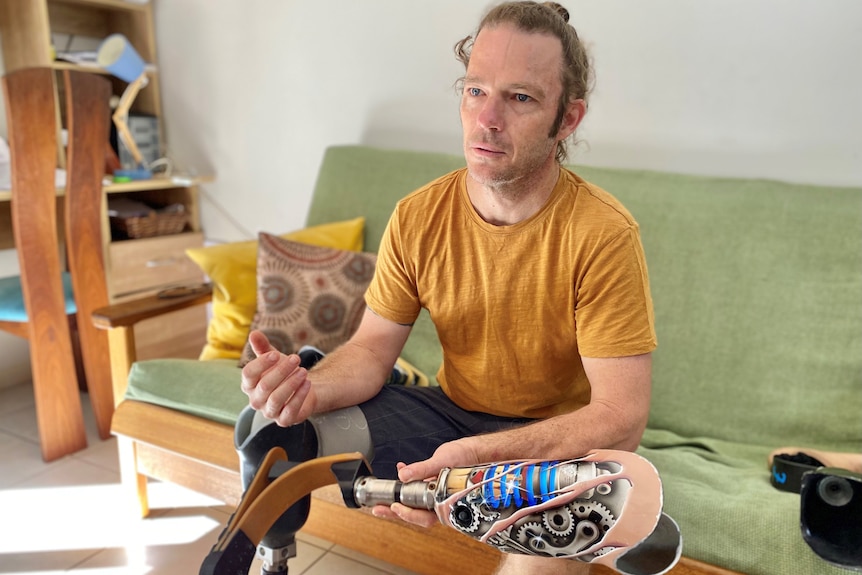 Man sitting on couch with prosthetic leg, talking