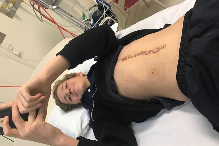 Hamish McMaster in bed with stitched up wound on his torso
