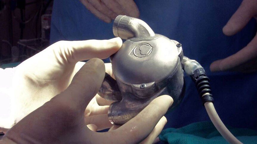 Doctors hold a new bionic heart that could last at least 10 years.