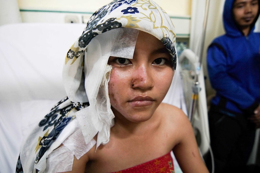 Widya Puspa Dewi sits on a hospital bed, her head covered by bandages and a headscarf