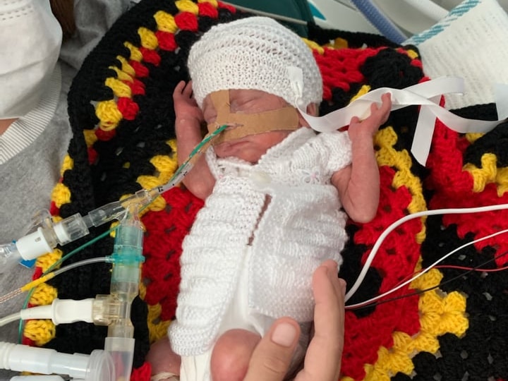 A premature baby with tubes up his nose lies on a blanket with the colours of the Indigenous flag