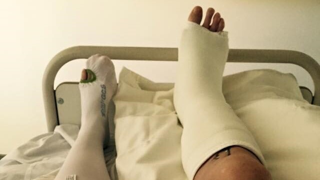 A broken leg in a cast