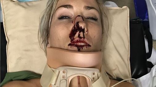 Caroline Buchanan lying in hospital bed.