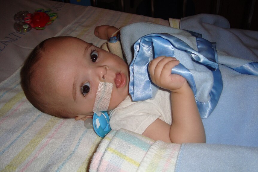 A baby lying in a bed with a little blue blanket. The baby has a tube up his nose, taped to his face. 