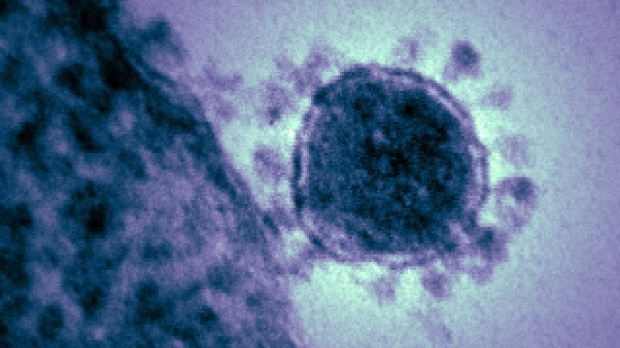 Coronavirus