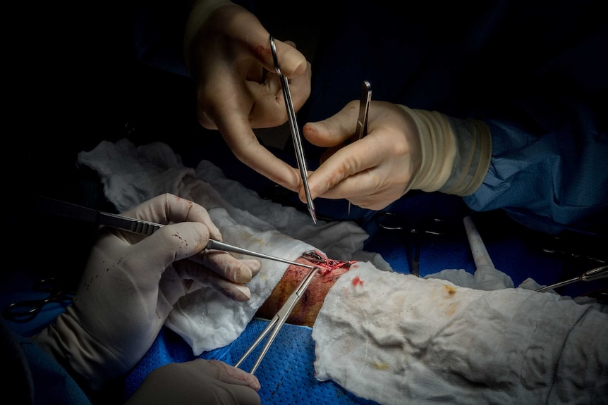A surgeon operates on a man's arm.