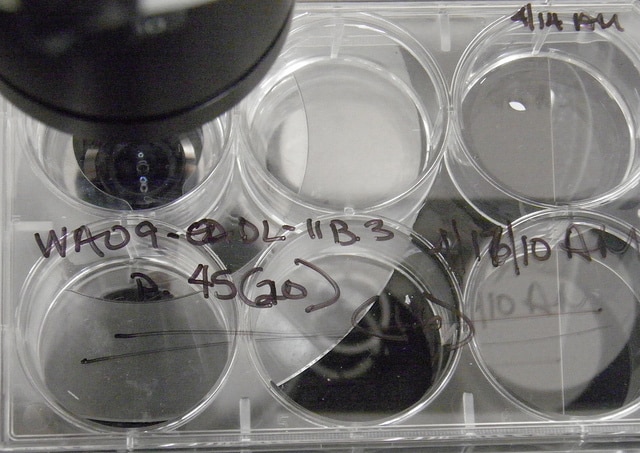 How does a stem cell transplant work? - ABC listen