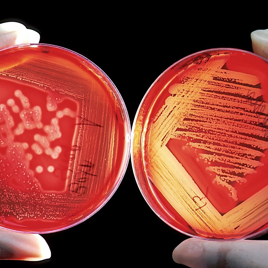 Two petri dishes containing red liquid being held up by gloved hands