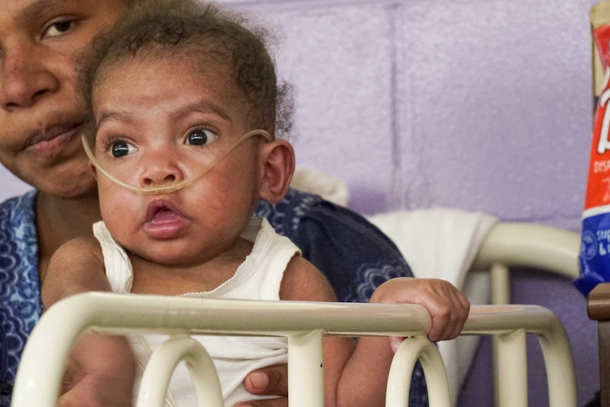 A baby wearing a nasal cannula sitting on its mothers lap