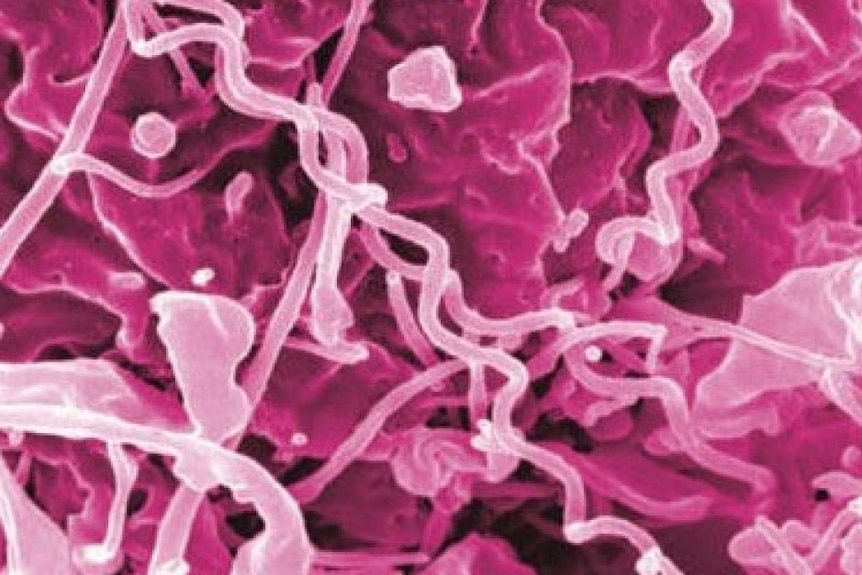 Treponema pallidum, bakteri yang menyebabkan sifilis.