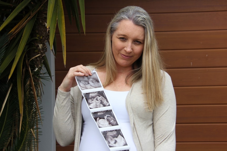 A pregnant woman holds a series of baby scans.