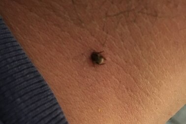 An insect about the size of a poppy seed had lodged itself within the trench of my inner elbow.