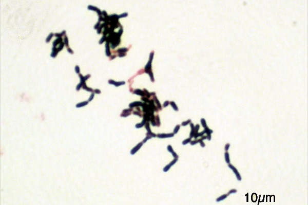 Bifidobacterium under the microscope