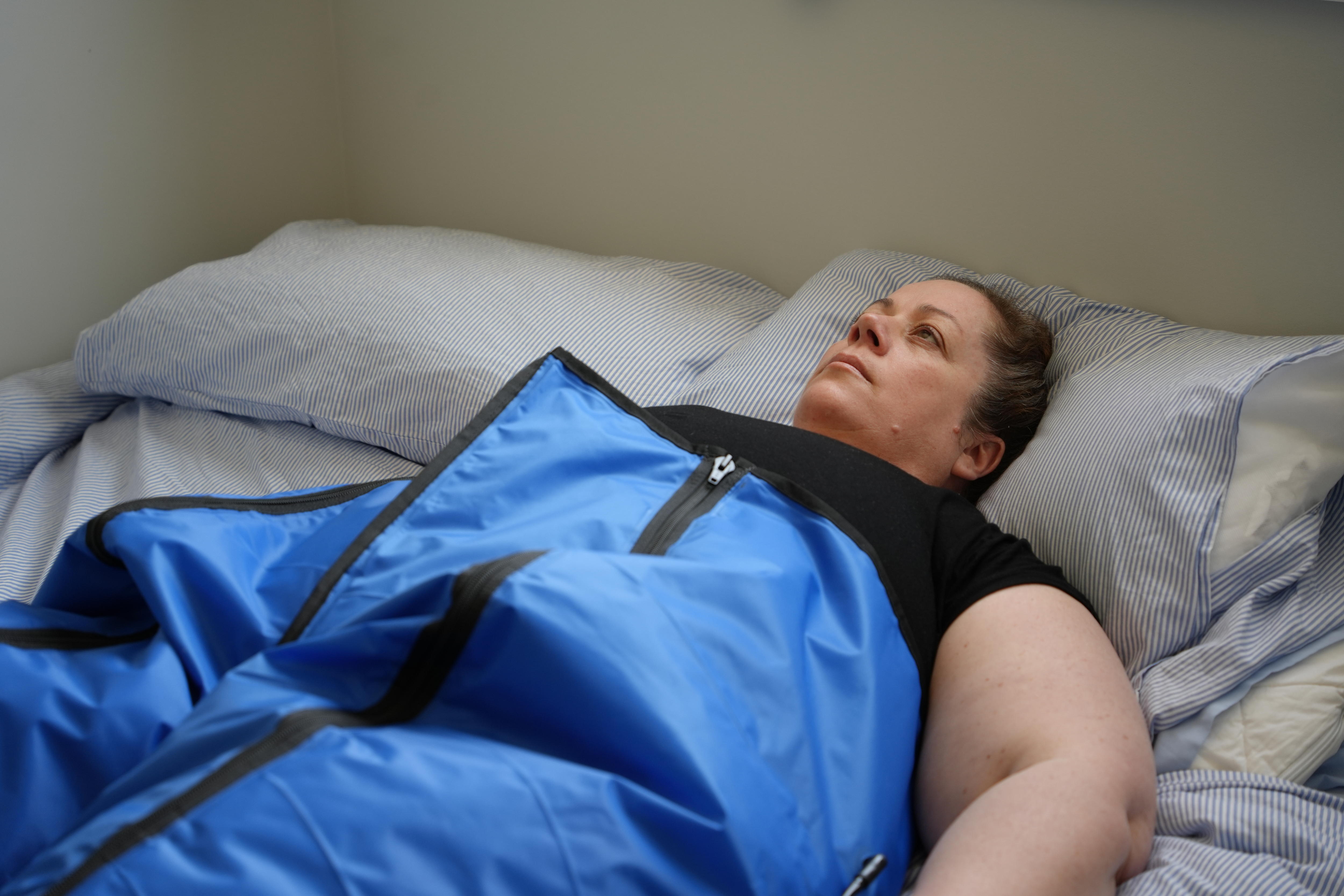 People with lipoedema face healthcare barriers, forcing some to relocate