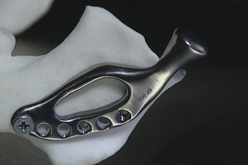 A 3D printed titanium jaw joint.