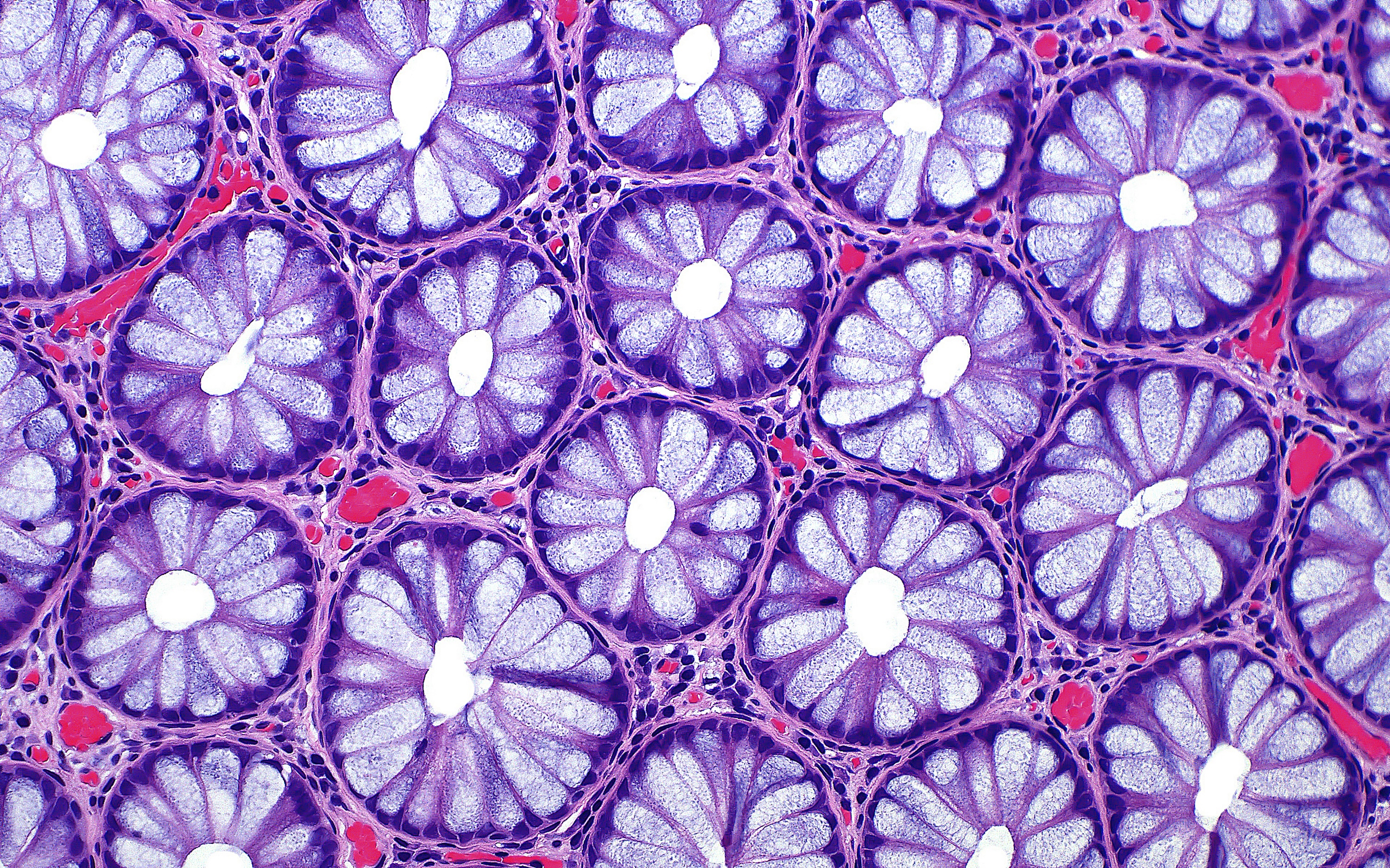 an extremely close-up picture taken with 20x magnification on a human colon, shown as purple and blue-coloured flower shapes