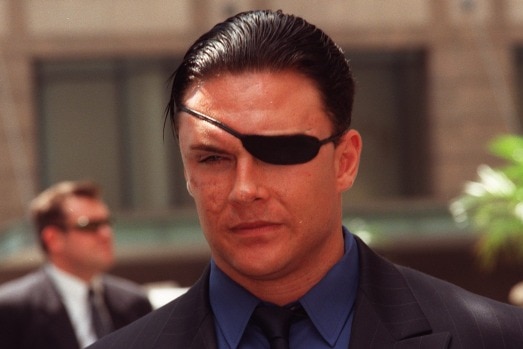 A man wears a patch over one eye.