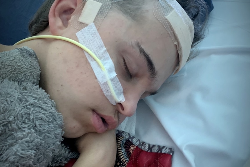 A close up of a young teenage boy's face sleeping in a hospital bed with a tube in his neck