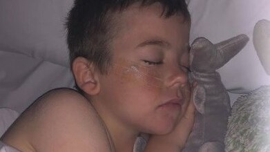 A little boy with a tube strapped to his face sleeps with a soft toy.