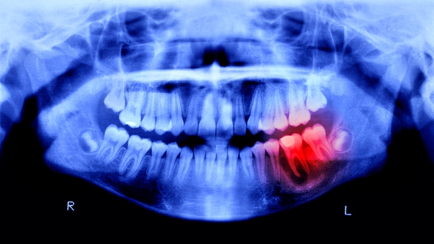 Why do humans suffer from dental problems so much?