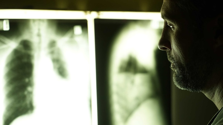 A man's face is silhouetted while looking at an xray or a person's ribcage