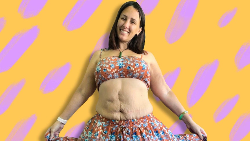 Woman in crop top and skirt smiling, showing stretch marks on stomach, in story about post-baby body acceptance.