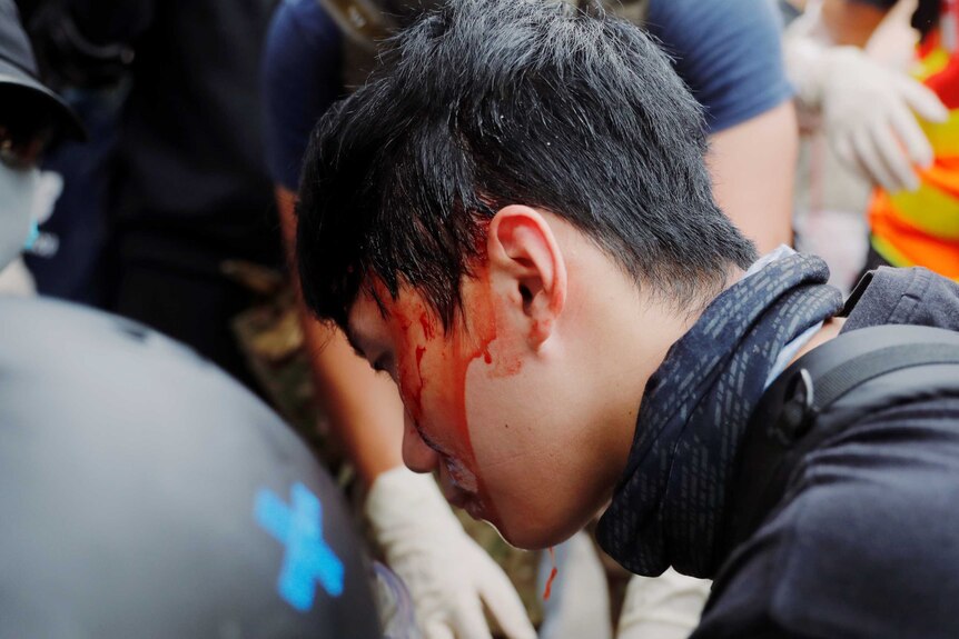 a protester with blood on his face