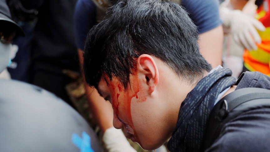 a protester with blood on his face