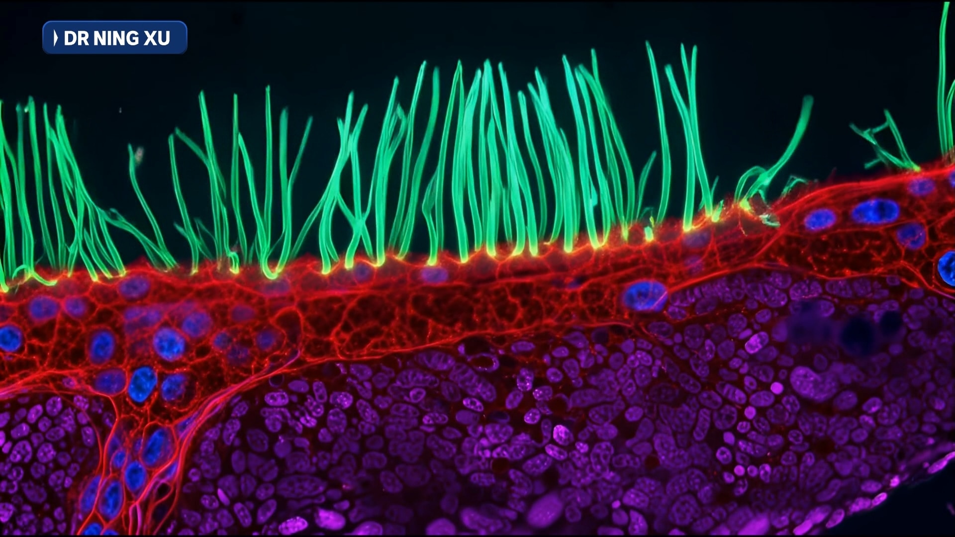 Microscopic image of cilia in the airways of a child.