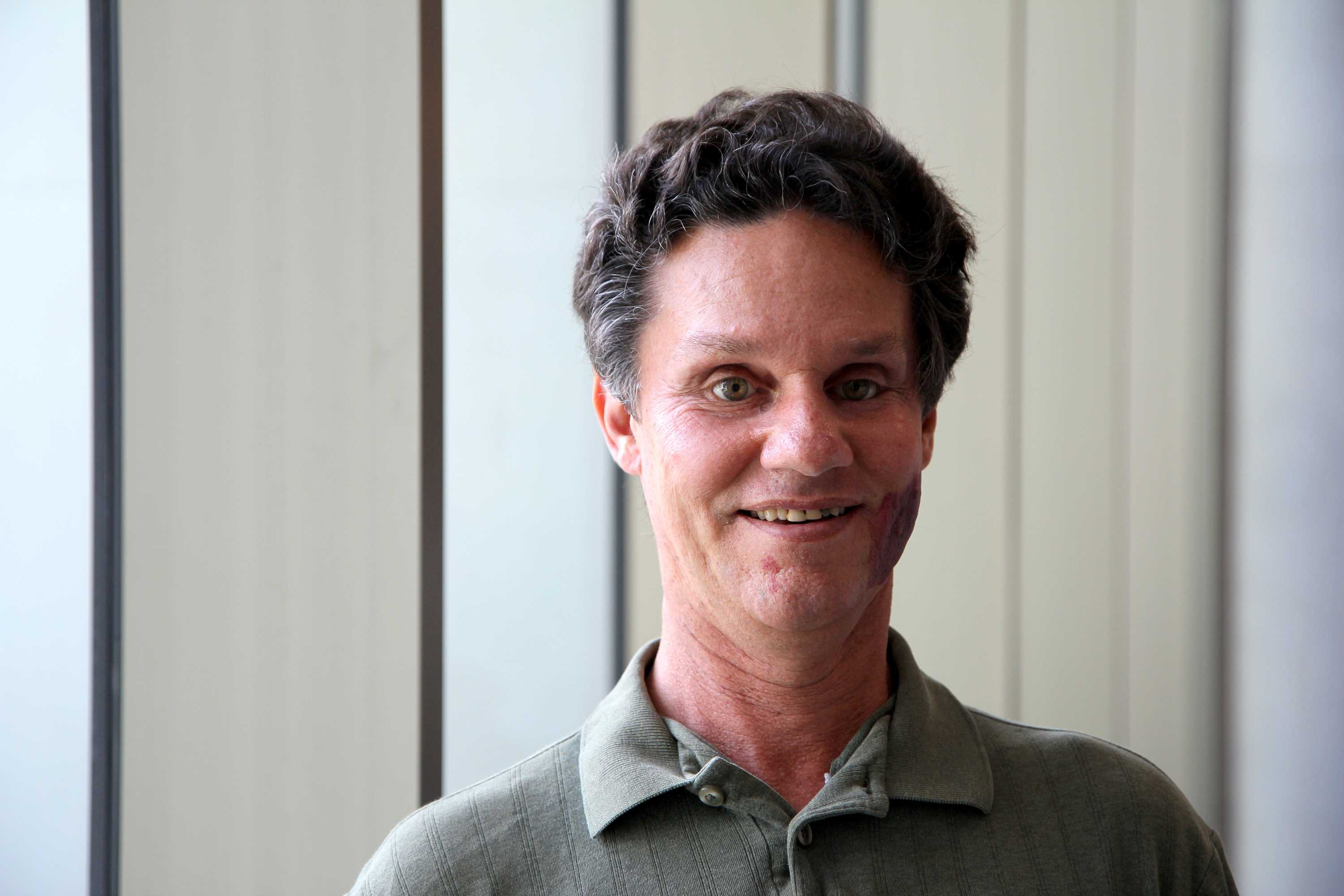 Daniel Kish: using sound to free the blind