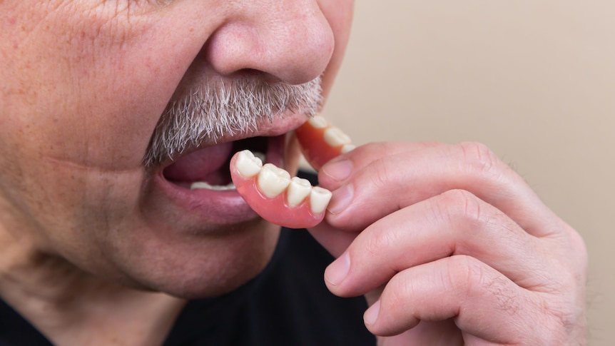 Man putting dentures into his mouth.