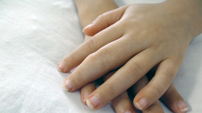 The swollen hands of a five-year-old girl diagnosed with arthritis.