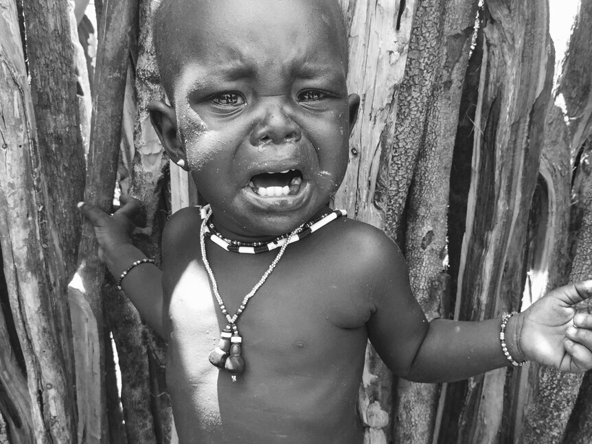 One-year-old twin Lokorot Lokora cries for food in Kapoeta.