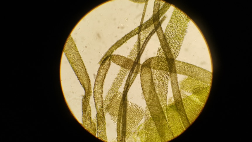 A photo through a microscope of strands of seaweed.