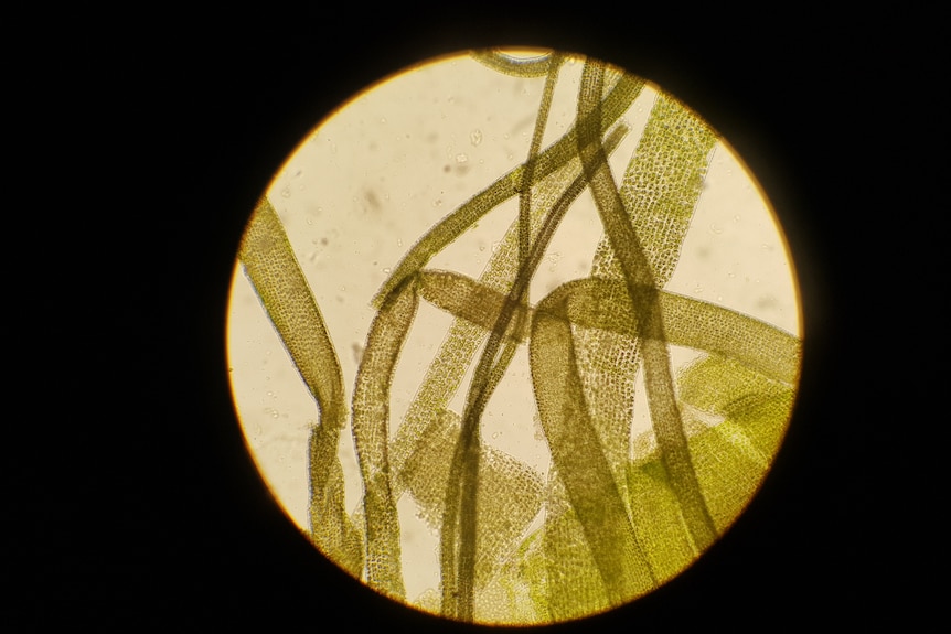 A photo through a microscope of strands of seaweed.