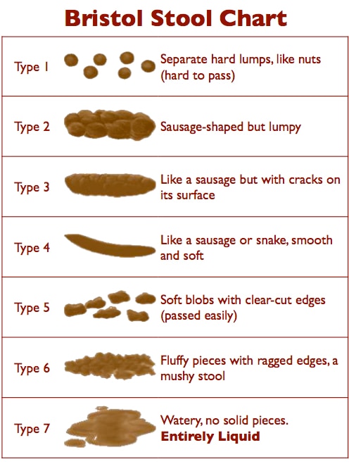 A chart showing the seven different forms of the human faeces.