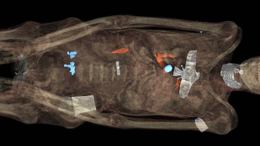X-ray of a mummy showing the jewellery on the body