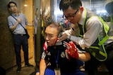 A man raises a bloody left hand as someone in a high-vis vest clasps a towel to the man's left ear which is severely wounded.