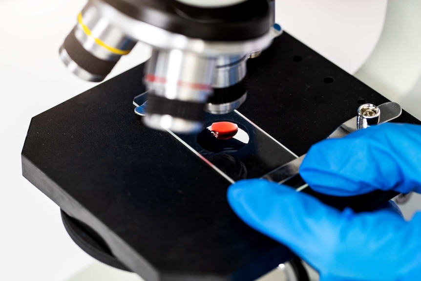 Close up of a microscope focused on a drop of blood.