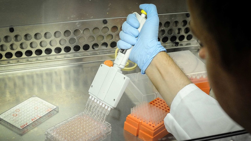 A scientist works on HIV virus cells.