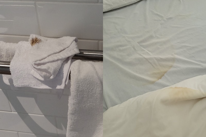 A photo of a white towel with a dark brown stain, and a photo of some sheets with a large brownish-yellow stain.